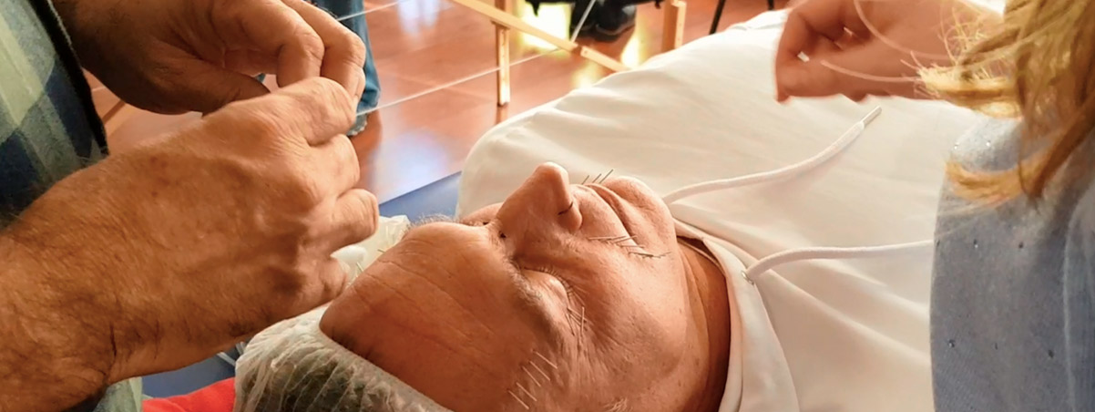 Acupuntura facial y corporal