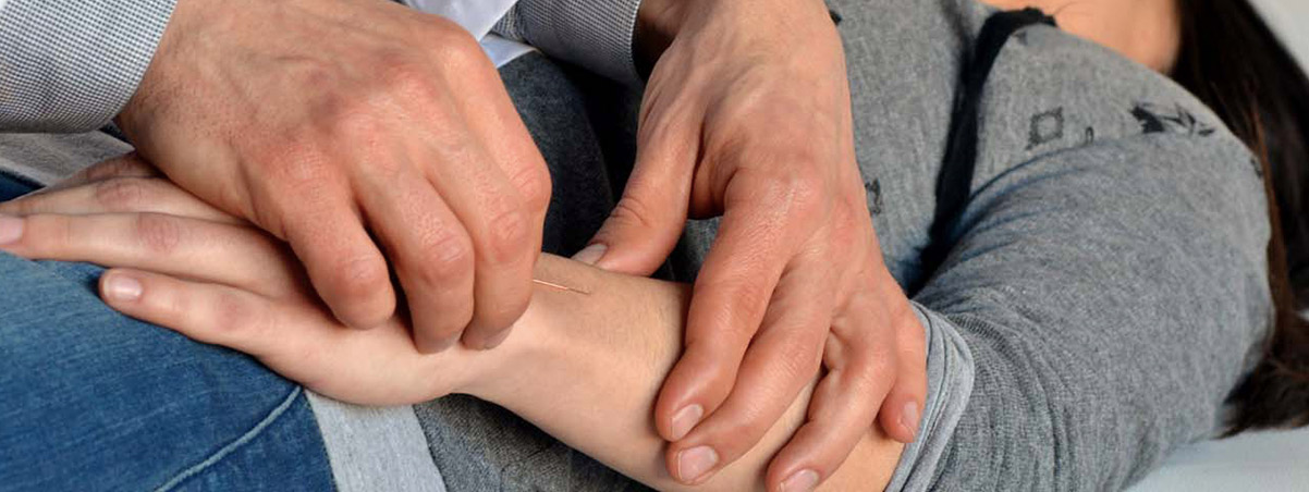 Acupuntura zonal