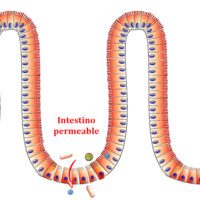 Principales pautas para evitar la hipermeabilidad intestinal intestino-permeable